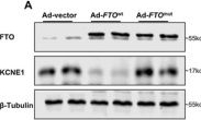 Fig.6.A showing Western Blotting in a Meleagris gallopavo (Turkey) sample from the publication: The m6A Demethylase Fto Enhances Susceptibility to Atrial Fibrillation by Demethylating Kcne1 in Aging Mice.