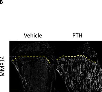 Fig.4.B showing Immunohistochemistry-immunofluorescence from the publication: MMP14 cleaves PTH1R in the chondrocyte-derived osteoblast lineage, curbing signaling intensity for proper bone anabolism.