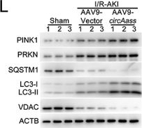 Fig.7.L showing Western Blotting from the publication: CircAASS alleviates renal injury and fibrosis by regulating mitochondrial homeostasis in tubular epithelial cells.