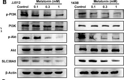 Fig.6.B showing Western Blotting in a Homo sapiens (Human) sample from the publication: Impaired redox adaptation through SLC38A5-dependent glutamine metabolism contributes to melatonin-mediated anoikis sensitivity and metastasis suppression in bone cancer.