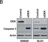 Fig.4.B showing Western Blotting in a Homo sapiens (Human) sample from the publication: DEK is a potential marker for aggressive phenotype and irinotecan-based therapy response in metastatic colorectal cancer.