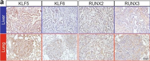 Fig.8.A showing Immunohistochemistry from the publication: SMAD4 induces opposite effects on metastatic growth from pancreatic tumors depending on the organ of residence.