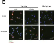 Fig.7.E showing Immunofluorescence in a Homo sapiens (Human) sample from the publication: Raloxifene prevents stress granule dissolution, impairs translational control and promotes cell death during hypoxia in glioblastoma cells.