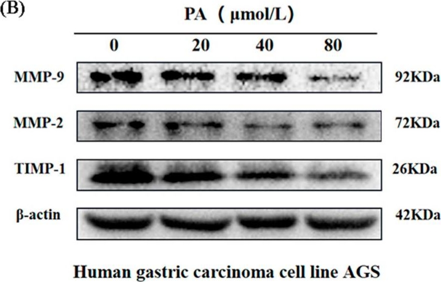 Fig.7.B showing Western Blotting in a Homo sapiens (Human) sample from the publication: Poria Acid, Triterpenoids Extracted from Poria cocos, Inhibits the Invasion and Metastasis of Gastric Cancer Cells.