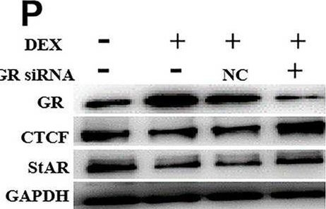 Fig.4.P showing Western Blotting in a Homo sapiens (Human) sample from the publication: Transgenerational inheritance of adrenal steroidogenesis inhibition induced by prenatal dexamethasone exposure and its intrauterine mechanism.