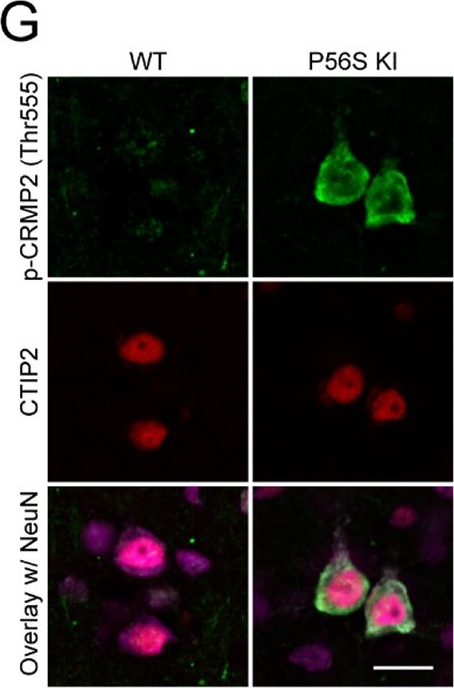 Fig.5.G showing Immunocytochemistry-immunofluorescence in a Mus musculus (House mouse) sample from the publication: Pathogenic mechanisms of amyotrophic lateral sclerosis-linked VAPB P56S mutation in the degeneration of corticospinal motor neurons.