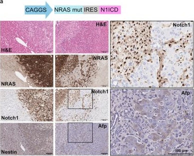 Fig.8.A showing Immunohistochemistry in a Mus musculus (House mouse) sample from the publication: Titration of RAS alters senescent state and influences tumour initiation.