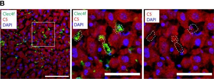 Fig.3.B showing Immunohistochemistry-immunofluorescence from the publication: The C1q-ApoE complex: A new hallmark pathology of viral hepatitis and nonalcoholic fatty liver disease.