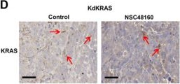 Fig.3.D showing Immunohistochemistry from the publication: Targeting KRAS Sensitizes Ferroptosis by Coordinately Regulating the TCA Cycle and Nrf2-SLC7A11-GPX4 Signaling in Hepatocellular Carcinoma.