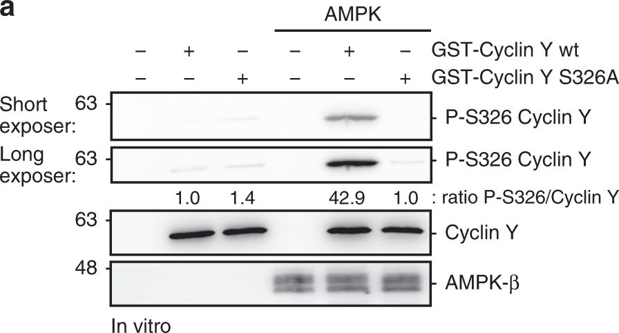 Fig.2.A showing Western Blotting in a Homo sapiens (Human) sample from the publication: AMPK-dependent activation of the Cyclin Y/CDK16 complex controls autophagy.