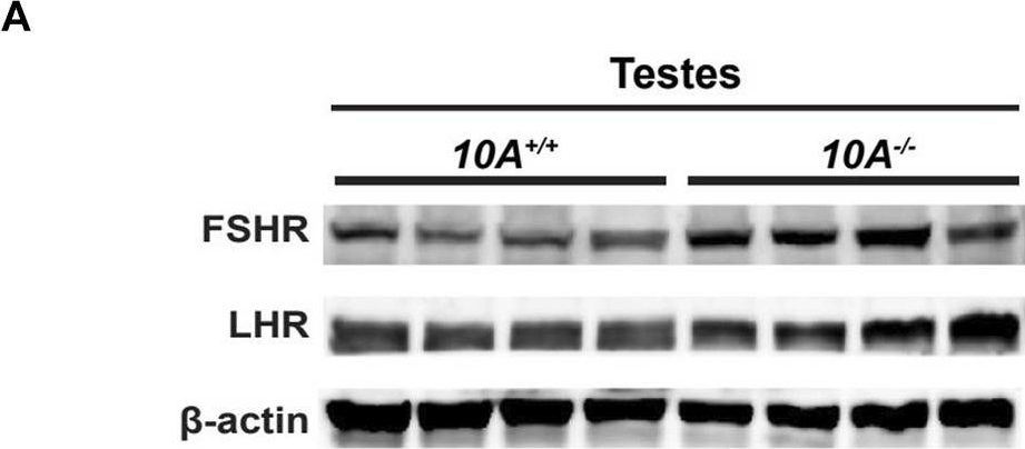 Fig.5.A showing Western Blotting in a Mus musculus (House mouse) sample from the publication: ATP10A deficiency results in male-specific infertility in mice.