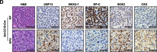 Fig.7.D showing Immunohistochemistry in a Mus musculus (House mouse) sample from the publication: USP13 drives lung squamous cell carcinoma by switching lung club cell lineage plasticity.