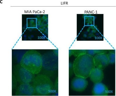 Fig.2.C showing Immunocytochemistry-immunofluorescence in a Homo sapiens (Human) sample from the publication: Repositioning Mifepristone as a Leukaemia Inhibitory Factor Receptor Antagonist for the Treatment of Pancreatic Adenocarcinoma.