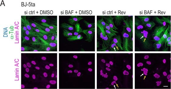 Fig.2.A showing Immunocytochemistry-immunofluorescence from the publication: Barrier-to-autointegration factor protects against the cGAS-STING response to chromatin bridges.