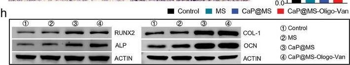 Fig.5.H showing Western Blotting from the publication: Injectable Nano-Micro Composites with Anti-bacterial and Osteogenic Capabilities for Minimally Invasive Treatment of Osteomyelitis.