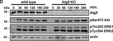 Fig.4.D showing Western Blotting in a Homo sapiens (Human) sample from the publication: Loss of the Essential Autophagy Regulators FIP200 or Atg5 Leads to Distinct Effects on Focal Adhesion Composition and Organization.