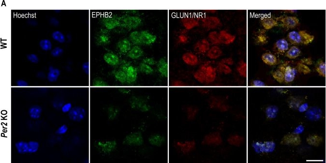 Fig.4.A showing Immunocytochemistry-immunofluorescence in a Mus musculus (House mouse) sample from the publication: Impact and Interrelationships of Striatal Proteins, EPHB2, OPRM1, and PER2 on Mild Cognitive Impairment.