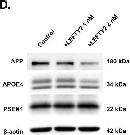 Fig.5.D showing Western Blotting from the publication: The Therapeutic Potential of ADSC-Secreted LEFTY2 in Treating Alzheimer's Disease.