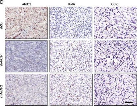 Fig.3.D showing Immunohistochemistry in a Mus musculus (House mouse) sample from the publication: Targeting HSPA1A in ARID2-deficient lung adenocarcinoma.
