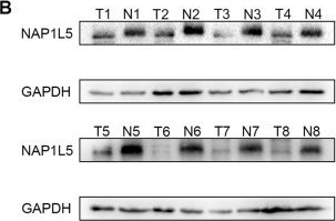 Fig.1.B showing Western Blotting from the publication: NAP1L5 targeting combined with MYH9 Inhibit HCC progression through PI3K/AKT/mTOR signaling pathway.