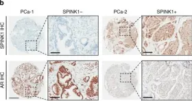 SPINK1 monoclonal antibody (M01), clone 4D4(H00006690-M01) | Abnova