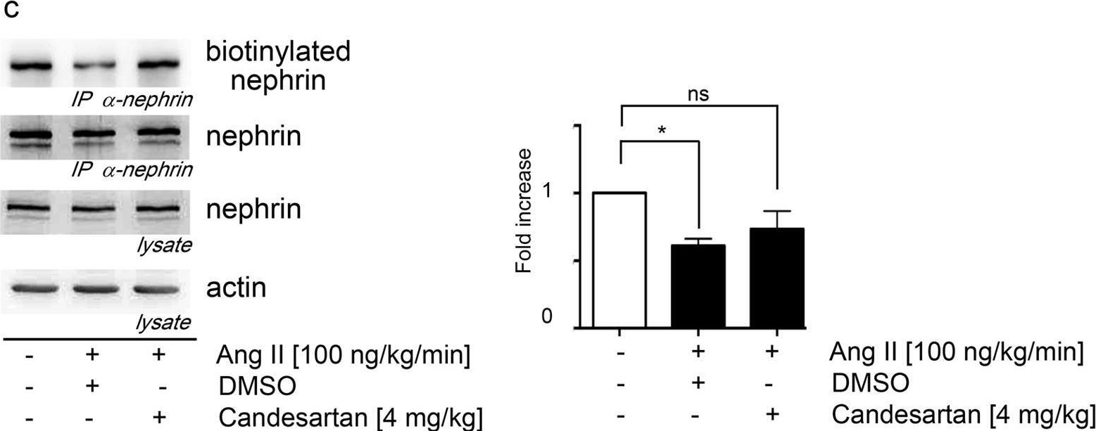 Angiotensin II increases glomerular permeability by β-arrestin mediated nephrin endocytosis.