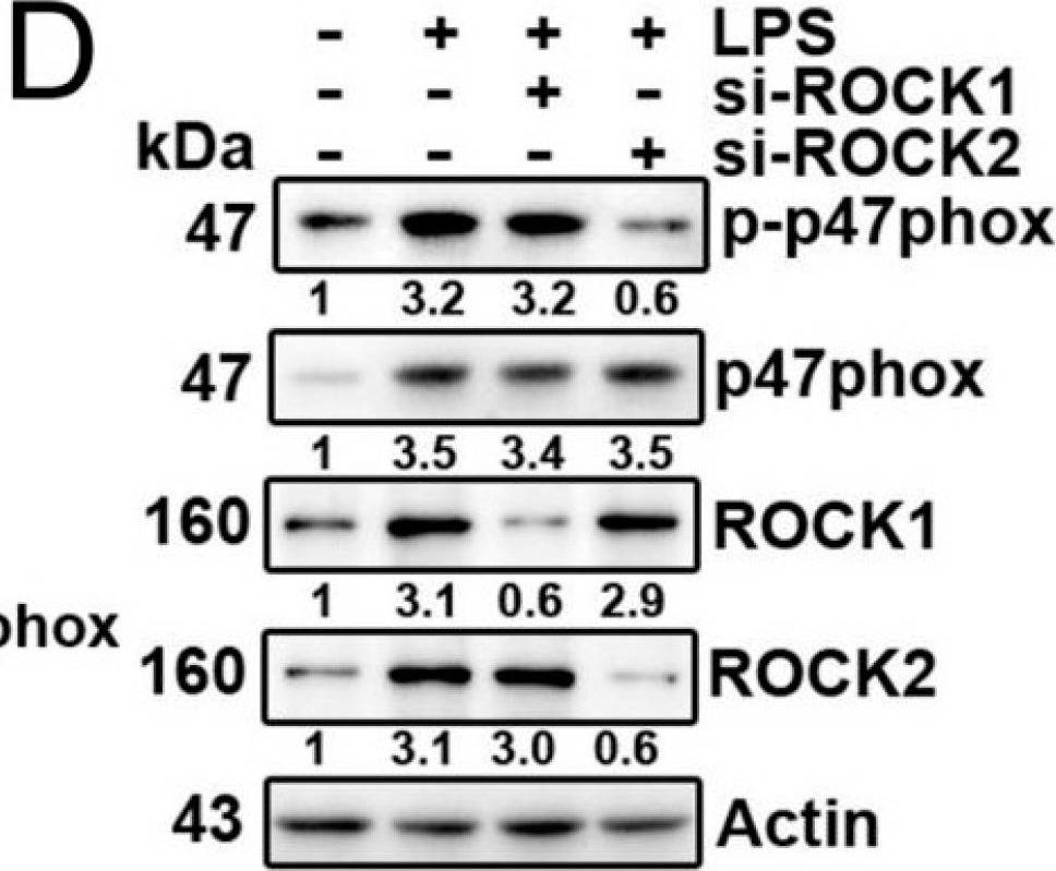 Fig.1.D showing Western Blotting in a Homo sapiens (Human) sample from the publication: Lipopolysaccharide Stimulates A549 Cell Migration through p-Tyr 42 RhoA and Phospholipase D1 Activity.