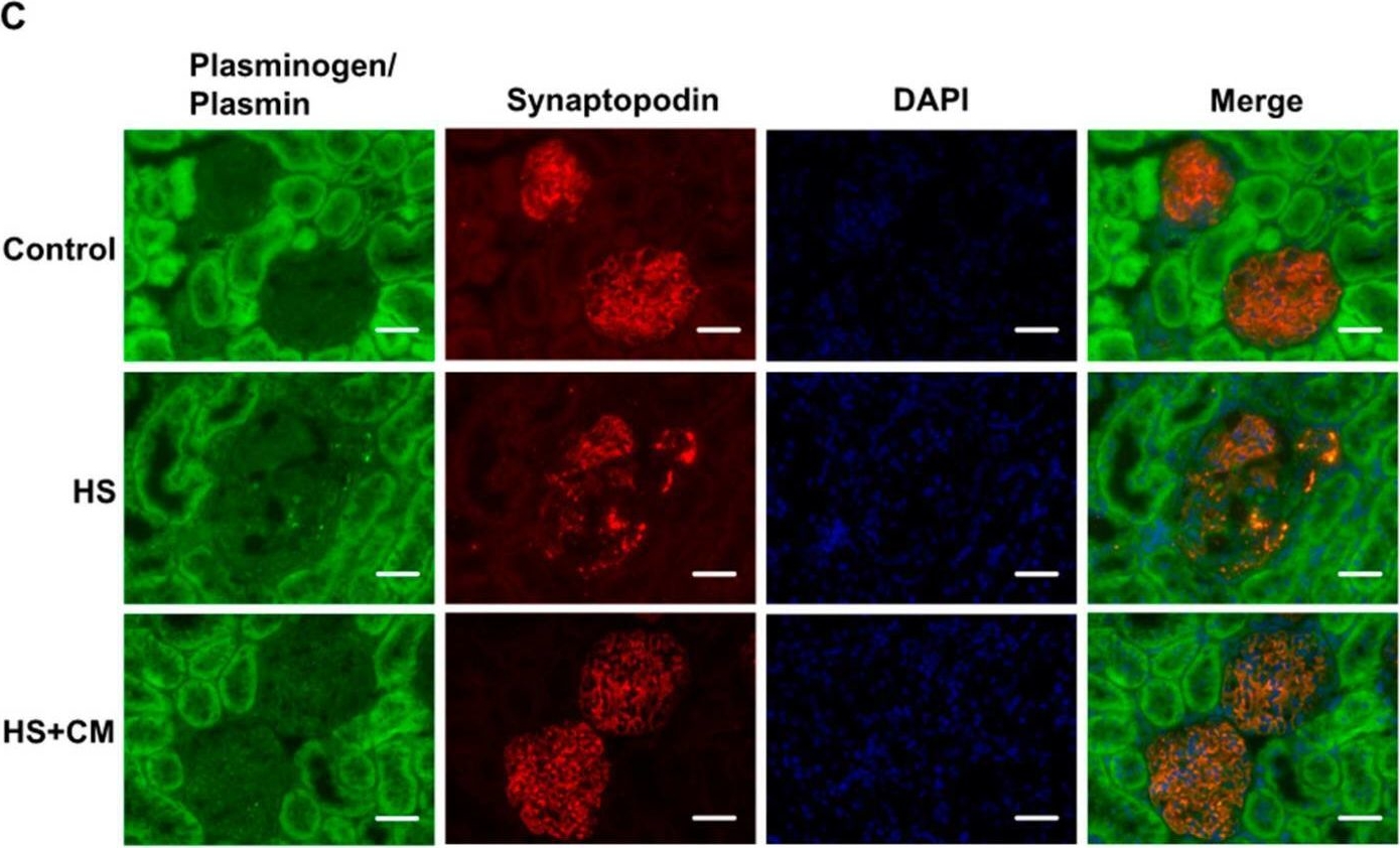 Fig.3.C showing Immunocytochemistry-immunofluorescence from the publication: A Serine Protease Inhibitor, Camostat Mesilate, Suppresses Urinary Plasmin Activity and Alleviates Hypertension and Podocyte Injury in Dahl Salt-Sensitive Rats.