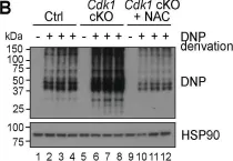 Fig.1.B showing Western Blotting from the publication: Remodeling of whole-body lipid metabolism and a diabetic-like phenotype caused by loss of CDK1 and hepatocyte division.