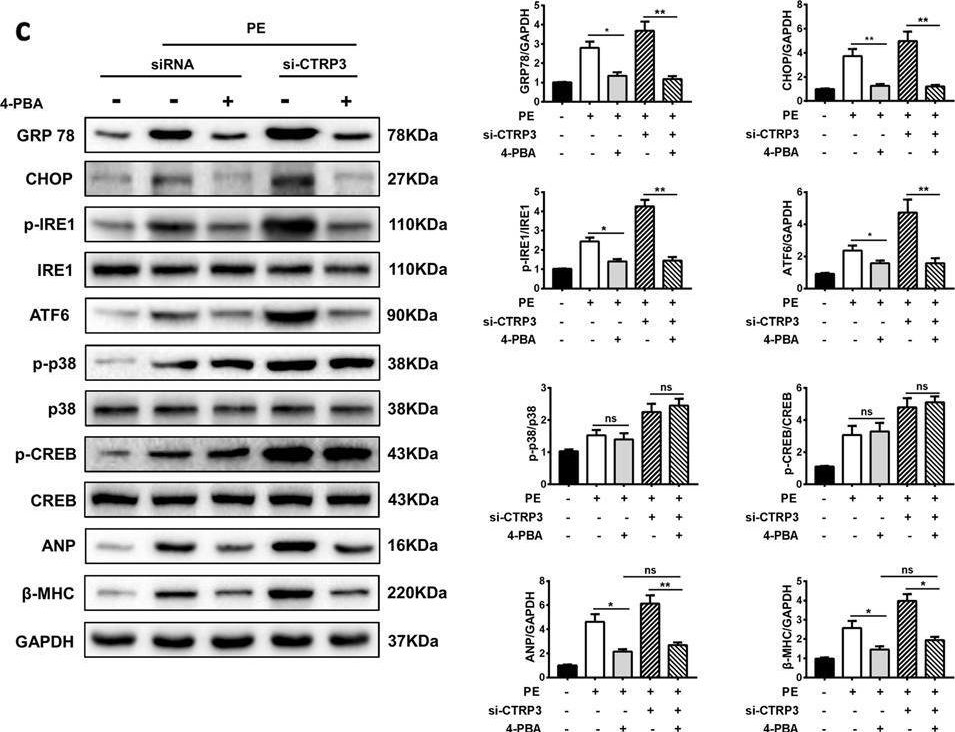 Fig.8.C showing Western Blotting from the publication: C1q-TNF-related protein-3 attenuates pressure overload-induced cardiac hypertrophy by suppressing the p38/CREB pathway and p38-induced ER stress.