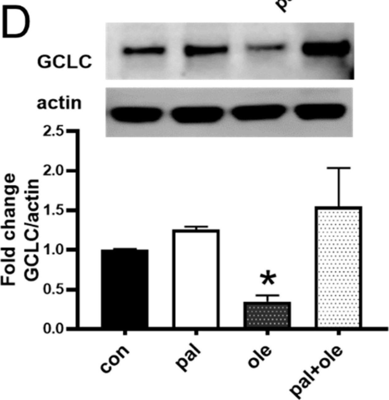 Fig.3.D showing Western Blotting in a Homo sapiens (Human) sample from the publication: Saturated Fatty Acid Activates T Cell Inflammation Through a Nicotinamide Nucleotide Transhydrogenase (NNT)-Dependent Mechanism.