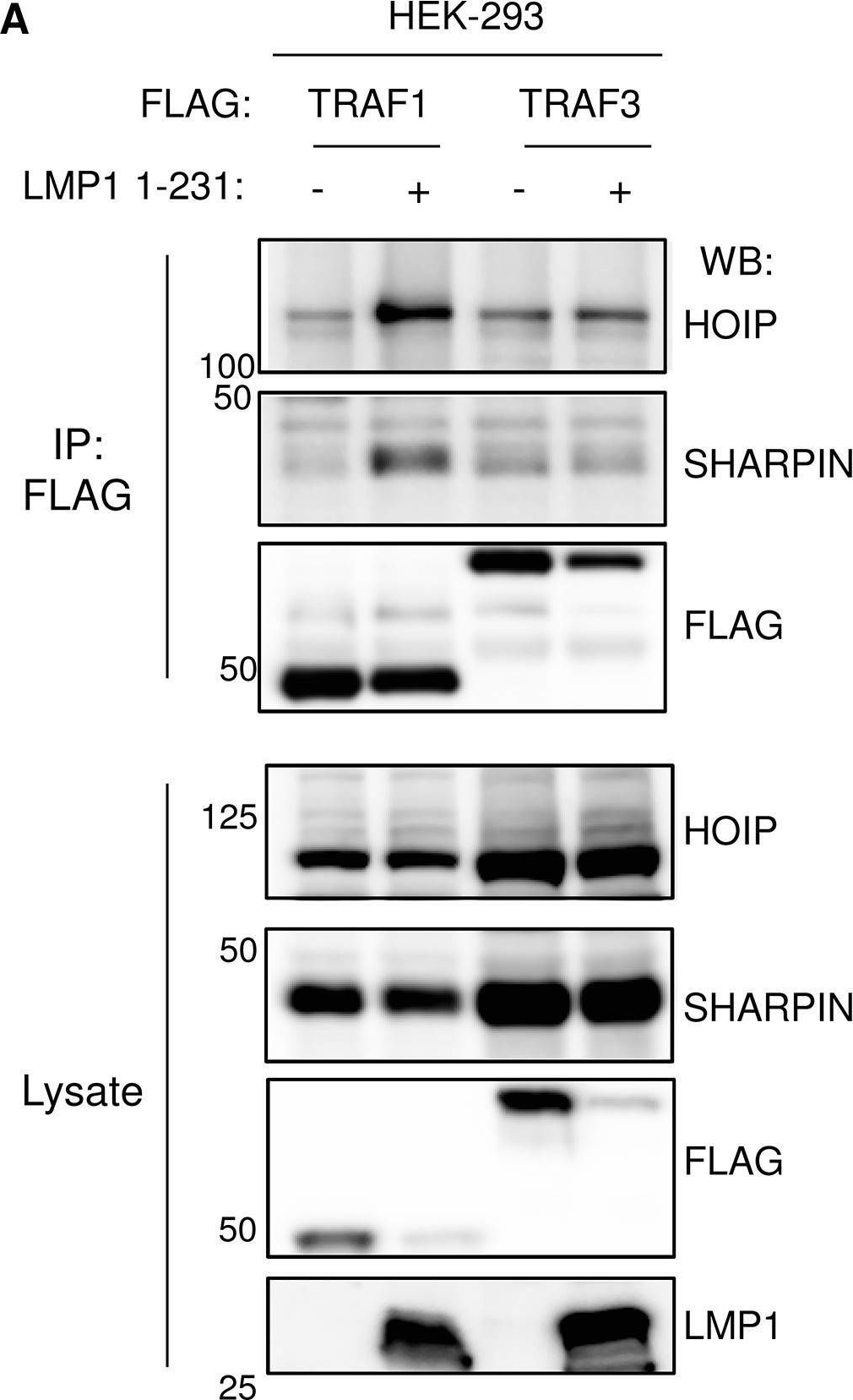 Fig.2.A showing Western Blotting in a Mus musculus (House mouse) sample from the publication: TRAF1 Coordinates Polyubiquitin Signaling to Enhance Epstein-Barr Virus LMP1-Mediated Growth and Survival Pathway Activation.