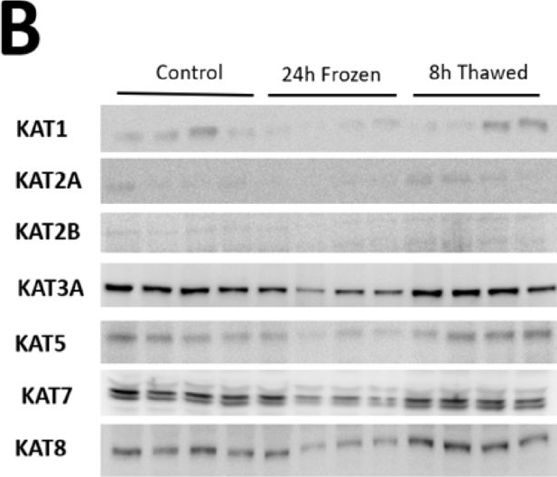 Fig.2.B showing Western Blotting from the publication: Contribution of reversible histone acetylation to freeze tolerance and recovery in wood frog kidneys.