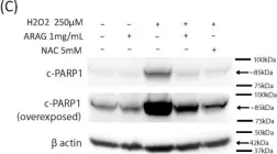 Fig.1.C showing Western Blotting from the publication: ARAG, an Antioxidant-Rich Gel, Shows Superiority to Mepilex Ag in the Treatment of Deep Partial Thickness Burns without Sacrificing Antimicrobial Efficiency.