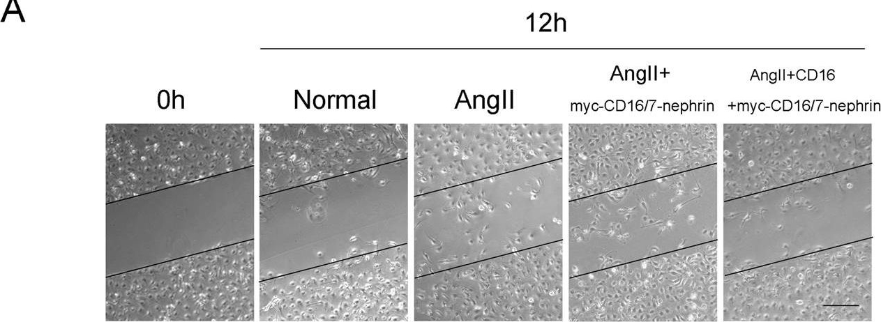 Role of c-Abl and nephrin in podocyte cytoskeletal remodeling induced by angiotensin II.