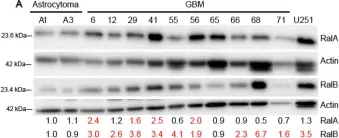 Fig.1.A showing Western Blotting from the publication: Antitumor Effects of Ral-GTPases Downregulation in Glioblastoma.