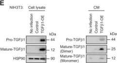 Fig.4.E showing Western Blotting in a Mus musculus (House mouse) sample from the publication: Hippo pathway in cancer cells induces NCAM1+αSMA+ fibroblasts to modulate tumor microenvironment.