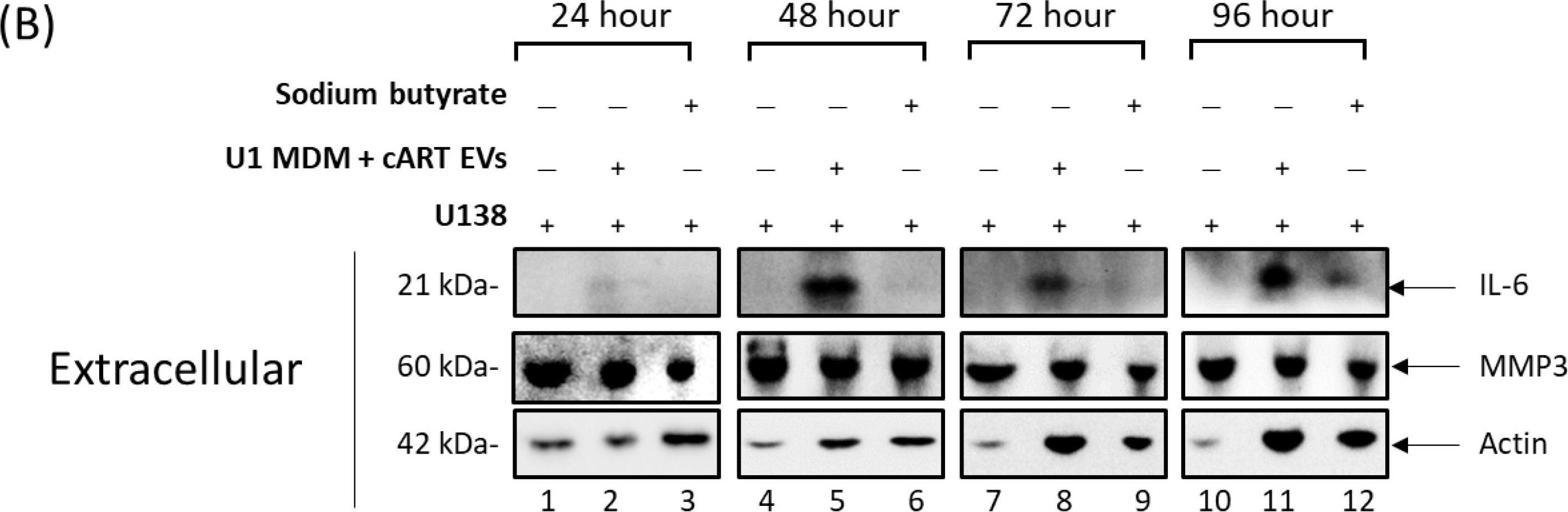 Fig.6.B showing Western Blotting from the publication: Autophagy Deregulation in HIV-1-Infected Cells Increases Extracellular Vesicle Release and Contributes to TLR3 Activation.