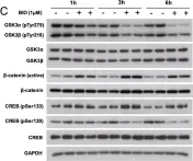 Fig.6.C showing Western Blotting from the publication: Silencing of hypothalamic FGF11 prevents diet-induced obesity.