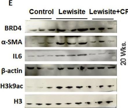 Fig.4.E showing Western Blotting from the publication: Inhibition of BRD4 prevents peribronchial fibrosis in mice with cutaneous lewisite exposure.