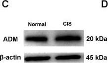 Fig.8.C showing Western Blotting in a Rattus norvegicus (Rat) sample from the publication: Genetic Architecture and Functional Implications of the CSF-Contacting Nucleus.