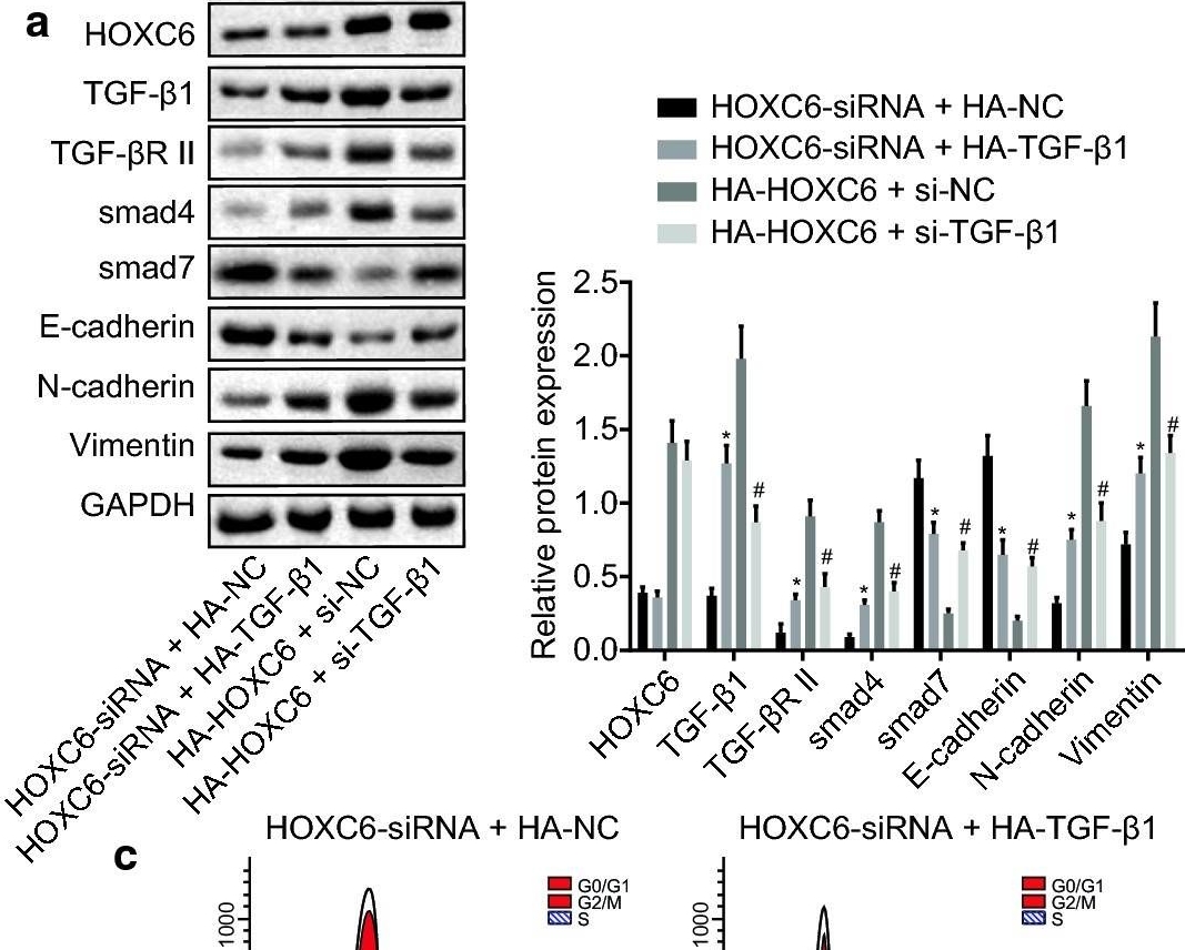 Fig.8.A showing Western Blotting in a Homo sapiens (Human) sample from the publication: HOXC6 gene silencing inhibits epithelial-mesenchymal transition and cell viability through the TGF-β/smad signaling pathway in cervical carcinoma cells.