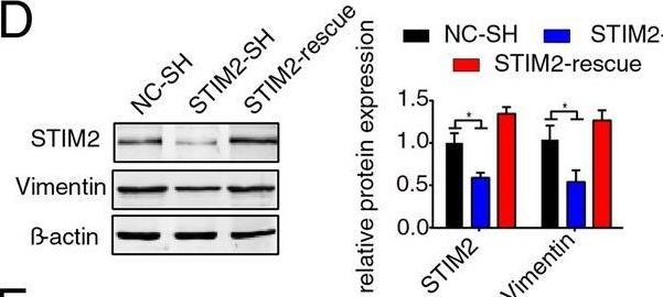 Fig.3.D showing Western Blotting in a Homo sapiens (Human) sample from the publication: Calcium-sensing stromal interaction molecule 2 upregulates nuclear factor of activated T cells 1 and transforming growth factor-β signaling to promote breast cancer metastasis.