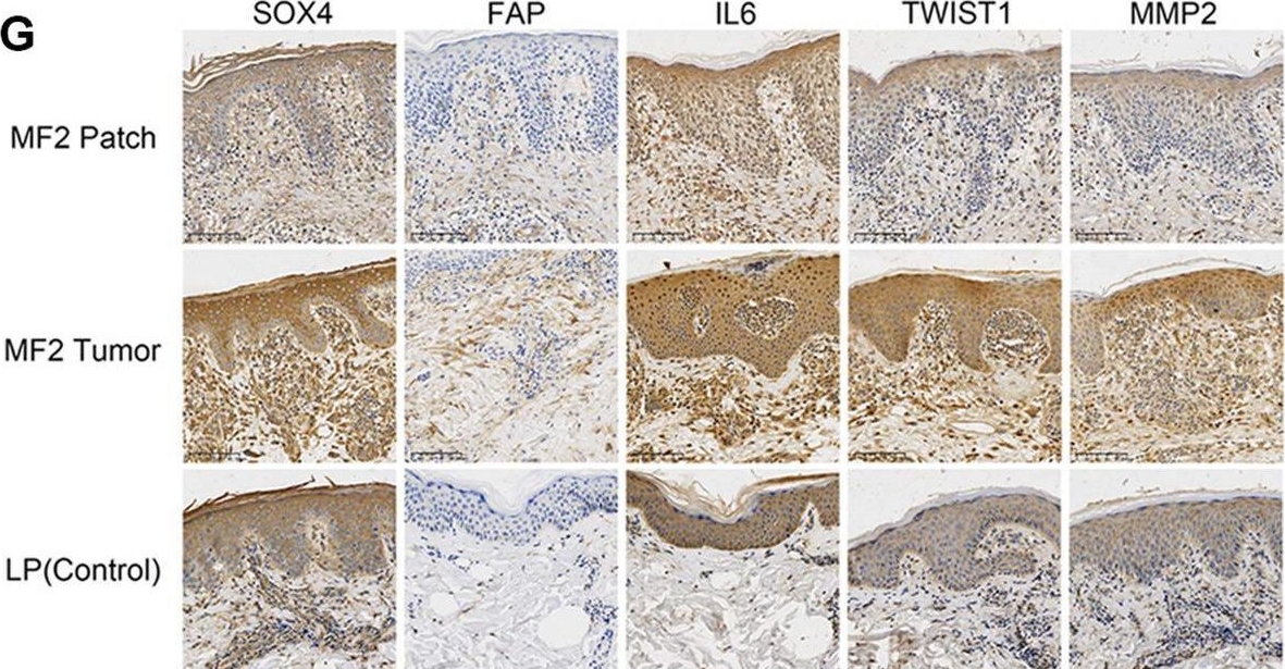 Fig.5.G showing Immunohistochemistry in a Homo sapiens (Human) sample from the publication: The cancer-associated fibroblasts interact with malignant T cells in mycosis fungoides and promote the disease progression.