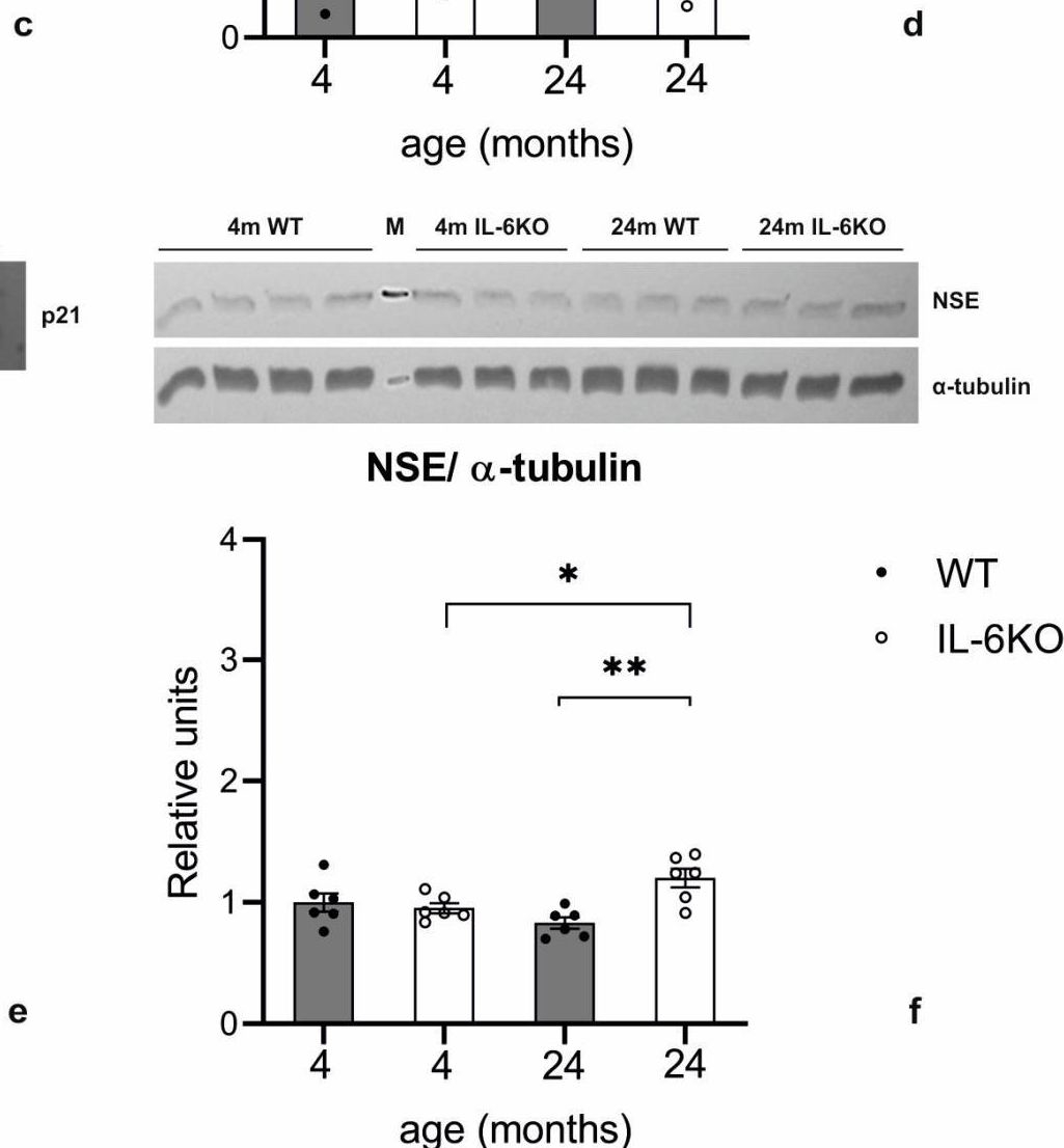 Fig.5.C showing Western Blotting in a Mus musculus (House mouse) sample from the publication: The Influence of Interleukin 6 Knockout on Age-Related Degenerative Changes in the Cerebellar Cortex of Mice.