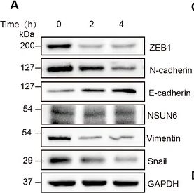 Fig.9.A showing Western Blotting in a Homo sapiens (Human) sample from the publication: AL398, A Novel NSUN6 Inhibitor, Attenuates Epithelial-Mesenchymal Transition and Metastasis in Endometrial Cancer by Abrogating m5C-Dependent Stabilization of Snail mRNA.