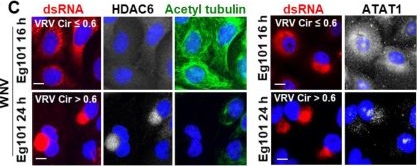 Fig.4.C showing Immunocytochemistry-immunofluorescence in a Homo sapiens (Human) sample from the publication: West Nile virus and Zika virus infections induce aggresome formation in human neural progenitor and A549 cells.