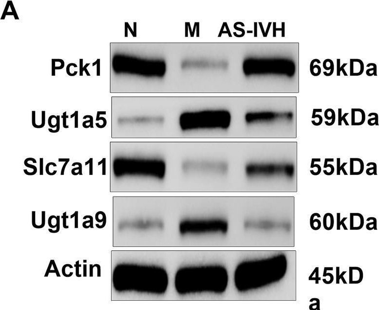 Fig.10.A showing Western Blotting in a Mus musculus (House mouse) sample from the publication: The gut-kidney axis is regulated by astragaloside IV to inhibit cyclosporine A-induced nephrotoxicity.