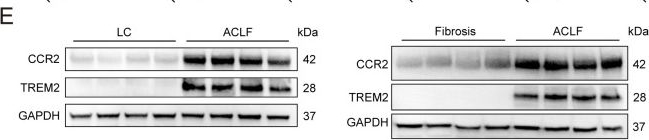Fig.7.E showing Western Blotting from the publication: Cross-species hepatic transcriptomics identify conserved immune-metabolic reprogramming in acute-on-chronic liver failure progression.