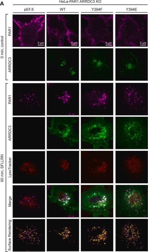 Fig.8.A showing Immunocytochemistry-immunofluorescence in a Homo sapiens (Human) sample from the publication: ARRDC3 tyrosine phosphorylation functions as a switch to control c-Src versus WWP2 interactions and distinct scaffolding functions.